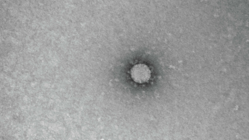 Немецкий врач озвучил новую версию возникновения пандемии коронавируса