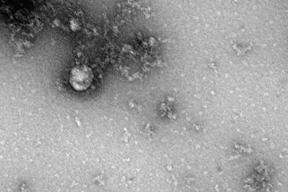 Роспотребнадзор показал первое изображение нового штамма коронавируса